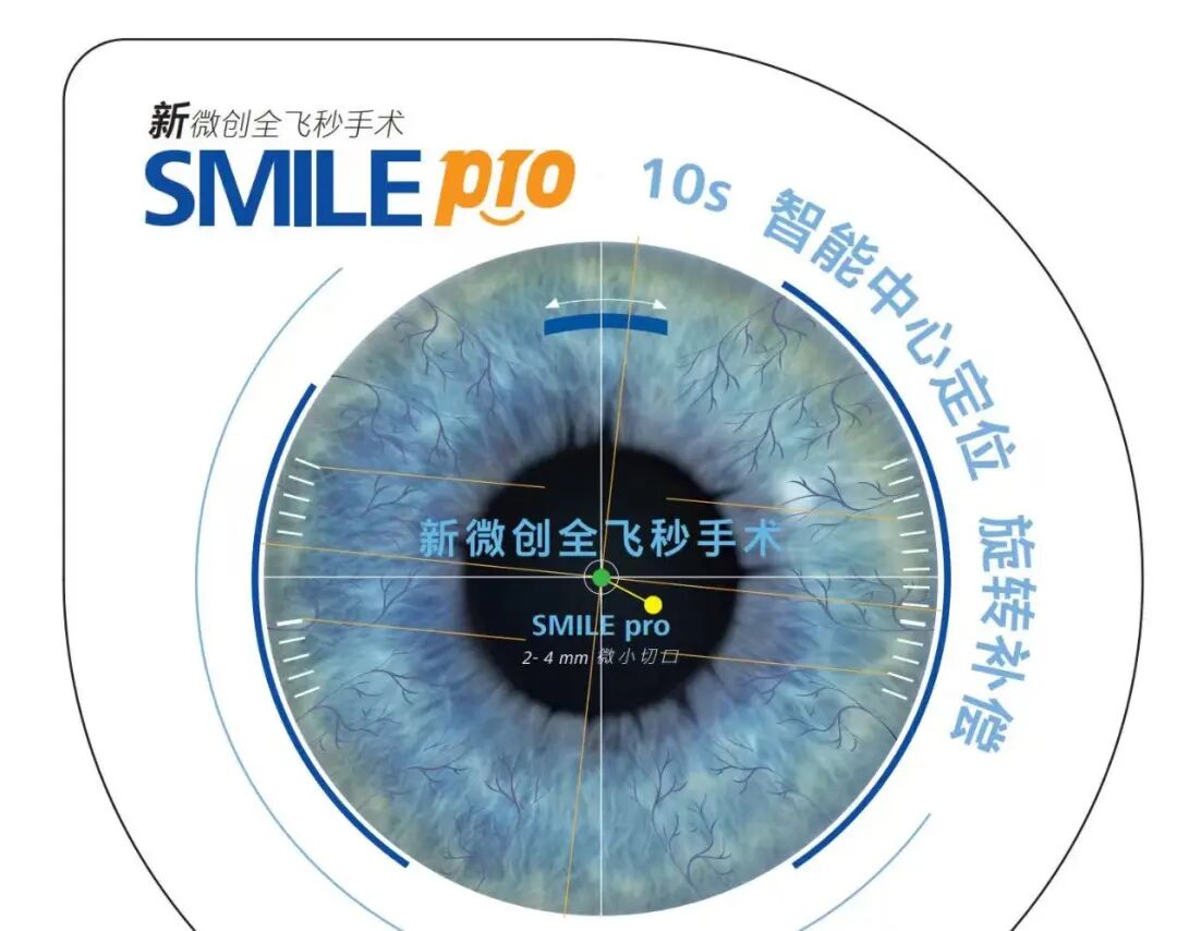 新全飞SMILE pro,超快10秒扫描,高考后让摘镜更安心